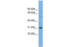 Image no. 1 for anti-Solute Carrier Organic Anion Transporter Family, Member 1B1 (SLCO1B1) (Middle Region) antibody (ABIN2781625)
