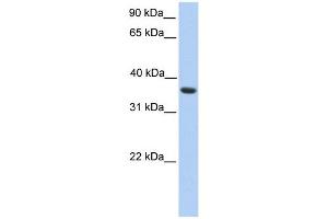 Image no. 1 for anti-Melanoma Antigen Family A, 4 (MAGEA4) (C-Term) antibody (ABIN632780)