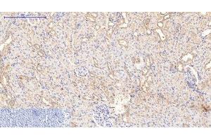 Immunohistochemistry of paraffin-embedded Rat kidney tissue using COL1A1 Monoclonal Antibody at dilution of 1:200.