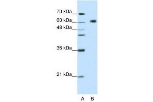 Image no. 3 for anti-Glucocorticoid Modulatory Element Binding Protein 2 (GMEB2) (C-Term) antibody (ABIN2780880)