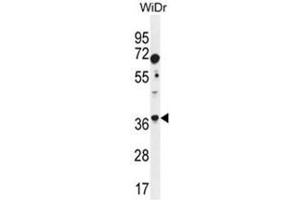 Image no. 2 for anti-Aldolase C, Fructose-Bisphosphate (ALDOC) (AA 79-108), (N-Term) antibody (ABIN950346)