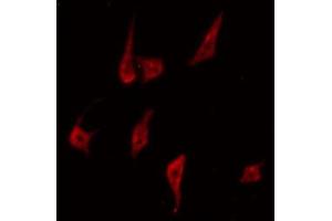 Image no. 1 for anti-Protein Kinase C, delta (PKCd) (pTyr313) antibody (ABIN6255881)