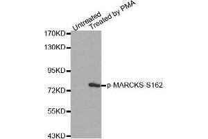Image no. 2 for anti-Myristoylated Alanine-Rich Protein Kinase C Substrate (MARCKS) (pSer162) antibody (ABIN3020358)