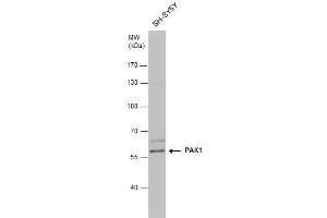 anti-P21-Activated Kinase 1 (PAK1) (Center) antibody