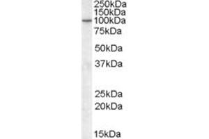Image no. 2 for anti-ArfGAP with GTPase Domain, Ankyrin Repeat and PH Domain 2 (AGAP2) (Internal Region) antibody (ABIN570975)