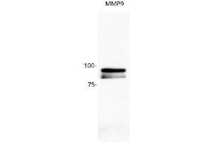 Image no. 4 for anti-Matrix Metallopeptidase 9 (Gelatinase B, 92kDa Gelatinase, 92kDa Type IV Collagenase) (MMP9) (AA 611-707) antibody (ABIN668095)