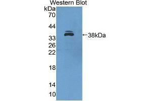 Image no. 1 for anti-Interferon Regulatory Factor 6 (IRF6) (AA 150-445) antibody (ABIN1859476)