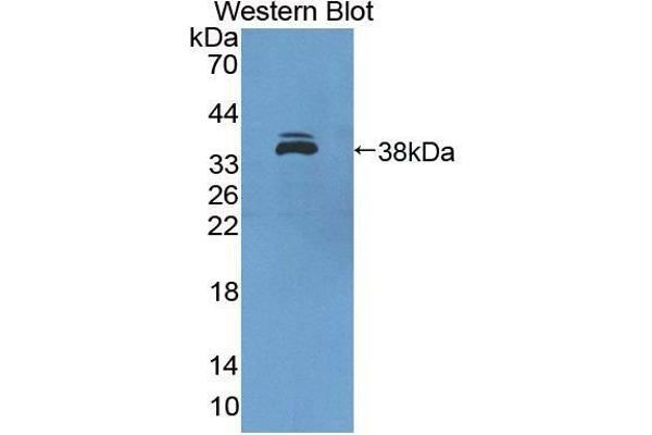 anti-Interferon Regulatory Factor 6 (IRF6) (AA 150-445) antibody