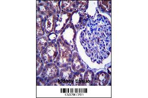 Image no. 2 for anti-Niemann-Pick Disease, Type C1 (NPC1) (AA 591-620) antibody (ABIN657395)