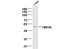 Hela lysates probed with TRAF2 Polyclonal Antibody, Unconjugated  at 1:300 dilution and 4˚C overnight incubation.