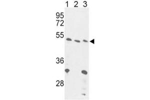 Image no. 2 for anti-Forkhead Box P3 (FOXP3) (AA 283-311) antibody (ABIN3030998)
