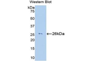 Image no. 1 for anti-Granzyme M (Lymphocyte Met-Ase 1) (GZMM) (AA 26-257) antibody (ABIN1172881)