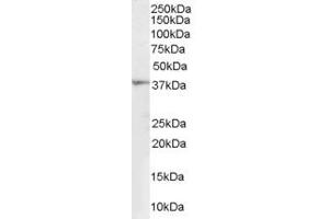 Image no. 1 for anti-ATP-Binding Cassette, Sub-Family A (ABC1), Member 2 (ABCA2) (N-Term) antibody (ABIN2781503)