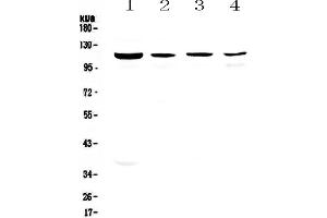 Image no. 1 for anti-Retinitis Pigmentosa GTPase Regulator (RPGR) (AA 13-338) antibody (ABIN5693297)