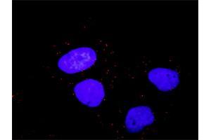 Image no. 3 for anti-V-Raf-1 Murine Leukemia Viral Oncogene Homolog 1 (RAF1) (AA 1-130) antibody (ABIN519618)