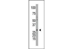 Image no. 3 for anti-Deoxycytidine Kinase (DCK) (AA 171-200), (C-Term) antibody (ABIN391125)