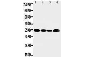 Image no. 3 for anti-Solute Carrier Family 16 (Monocarboxylic Acid Transporters), Member 4 (SLC16A4) (AA 134-148), (N-Term) antibody (ABIN3044003)