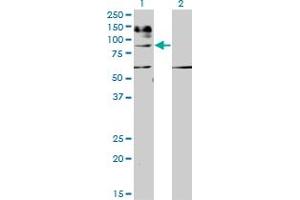 Image no. 3 for anti-Interleukin 31 Receptor A (IL31RA) (AA 21-120) antibody (ABIN566814)