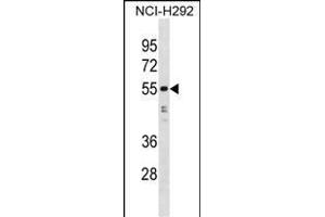 HNRNPH1 antibody  (N-Term)