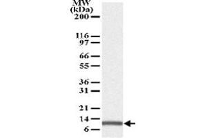 anti-Phorbol-12-Myristate-13-Acetate-Induced Protein 1 (PMAIP1) antibody