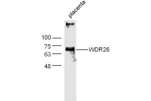 Image no. 4 for anti-WD Repeat Domain 26 (WDR26) (AA 101-200) antibody (ABIN729988)