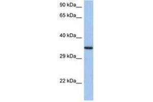 Image no. 1 for anti-HORMA Domain Containing 2 (HORMAD2) (AA 35-84) antibody (ABIN6743695)