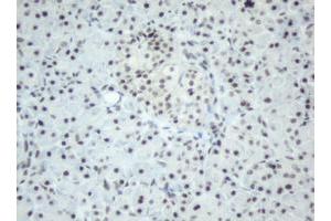 Image no. 3 for anti-Splicing Factor 3a, Subunit 1 (SF3A1) (AA 249-568) antibody (ABIN1491272)