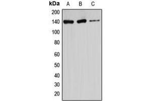 Image no. 2 for anti-Ataxin 2 (ATXN2) (Center) antibody (ABIN2705521)