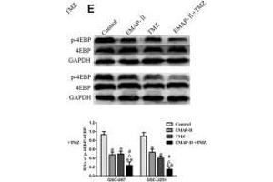 Image no. 2 for anti-Eukaryotic Translation Initiation Factor 4E Binding Protein 1 (EIF4EBP1) antibody (ABIN3021844)