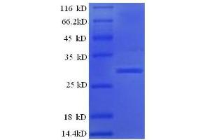 Image no. 1 for Kallikrein B, Plasma (Fletcher Factor) 1 (KLKB1) (AA 391-638) protein (His tag) (ABIN1473914)