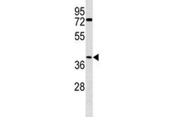 anti-Abhydrolase Domain Containing 1 (ABHD1) (AA 289-315) antibody