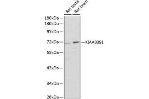 KIAA0391 抗体  (AA 314-583)
