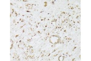 CIAPIN1 antibody