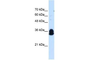 Image no. 1 for anti-Family with Sequence Similarity 134, Member B (FAM134B) (Middle Region) antibody (ABIN2782026)