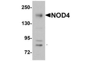 Image no. 1 for anti-NLR Family, CARD Domain Containing 5 (NLRC5) (N-Term) antibody (ABIN783699)