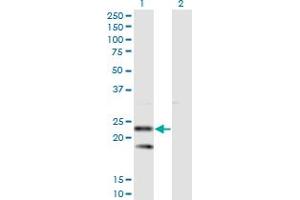 Image no. 1 for anti-Signal Sequence Receptor, beta (Translocon-Associated Protein Beta) (SSR2) (AA 51-150) antibody (ABIN520506)