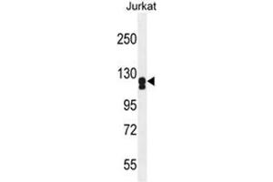 ADCY2 Antibody (Center) western blot analysis in Jurkat cell line lysates (35 µg/lane).