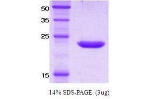Image no. 1 for Killer Cell Immunoglobulin-Like Receptor, Two Domains, Short Cytoplasmic Tail, 4 (KIR2DS4) protein (ABIN934899)