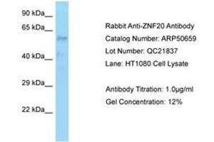 anti-Zinc Finger Protein 20 (ZNF20) (AA 449-498) antibody