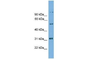 Image no. 1 for anti-Iroquois Homeobox Protein 2 (IRX2) (C-Term) antibody (ABIN2779945)
