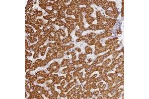 Image no. 1 for anti-Solute Carrier Family 38, Member 9 (SLC38A9) antibody (ABIN5588201)