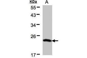 WB Image Sample(30 μg of whole cell lysate) A:H1299 12% SDS PAGE antibody diluted at 1:500