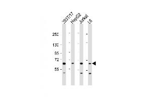 Image no. 2 for anti-Pyruvate Dehydrogenase Phosphatase (PDP) (AA 308-336) antibody (ABIN656386)
