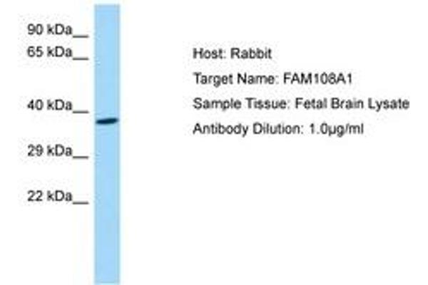 anti-Abhydrolase Domain Containing 17A (ABHD17A) (AA 245-294) antibody