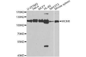 Image no. 5 for anti-Minichromosome Maintenance Complex Component 6 (MCM6) antibody (ABIN3022687)