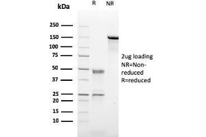anti-Complement Component (3d/Epstein Barr Virus) Receptor 2 (CR2) (AA 142-240) antibody
