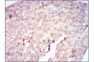 Image no. 1 for anti-V-Raf-1 Murine Leukemia Viral Oncogene Homolog 1 (RAF1) antibody (ABIN969559)