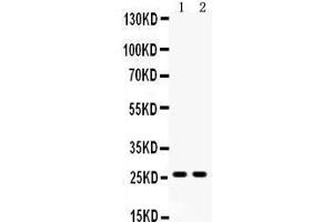 Image no. 1 for anti-Deoxyuridine Triphosphatase (DUT) (AA 212-229), (C-Term) antibody (ABIN3044322)