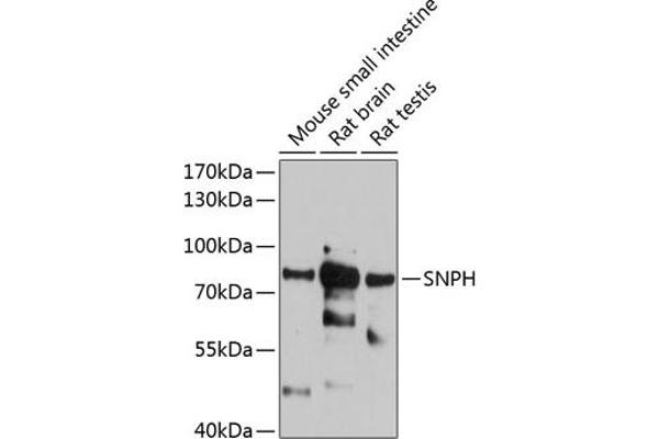 Syntaphilin antibody  (AA 300-425)