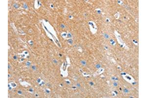 The image on the left is immunohistochemistry of paraffin-embedded Human brain tissue using ABIN7131012(SEPT9 Antibody) at dilution 1/15, on the right is treated with fusion protein.